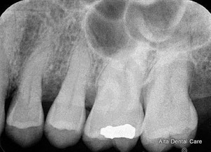 Periodontal