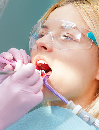 Root Canal