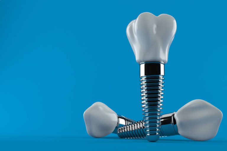 How Long After Extraction Can I Have an Implant? Alta Dental Care Blog