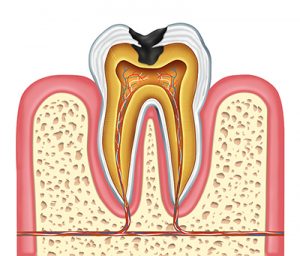 cross section tooth