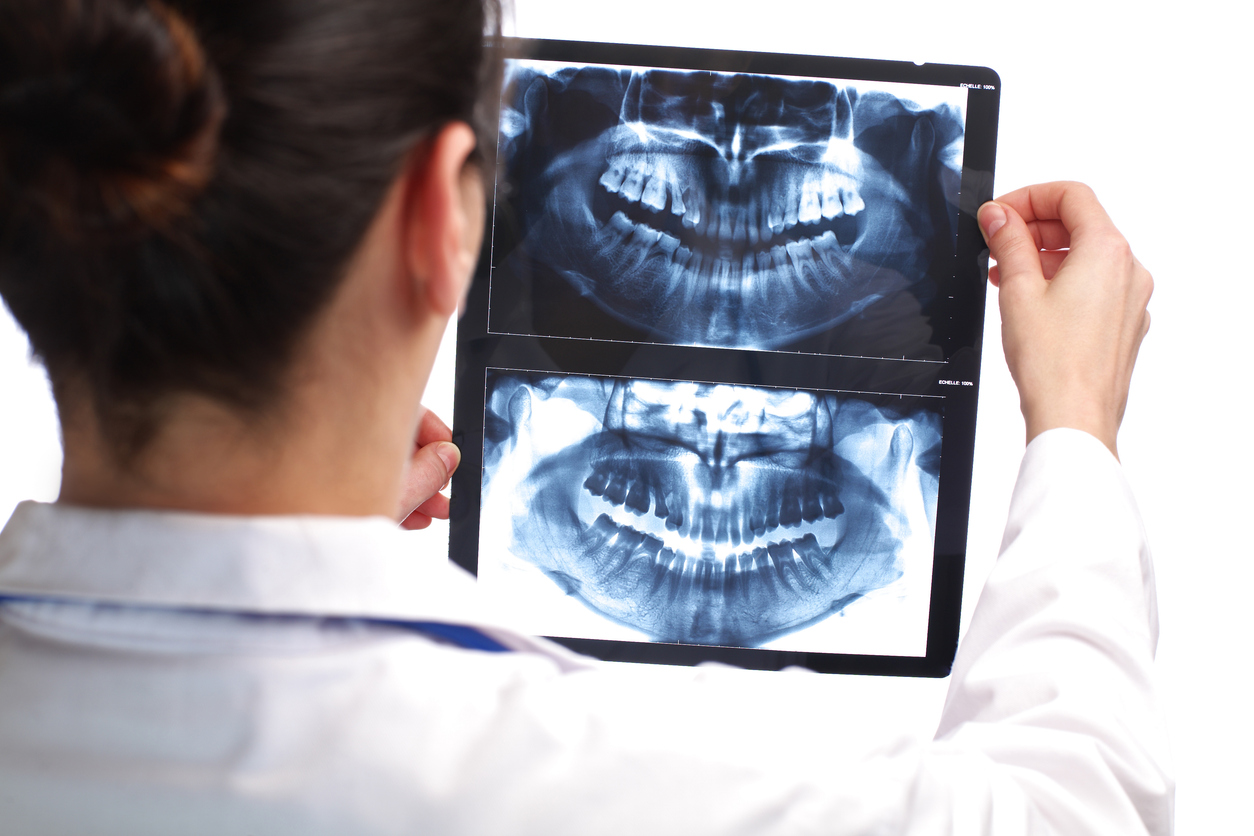 Featured image for The Importance of Dental X-Rays in Preventative Dentistry