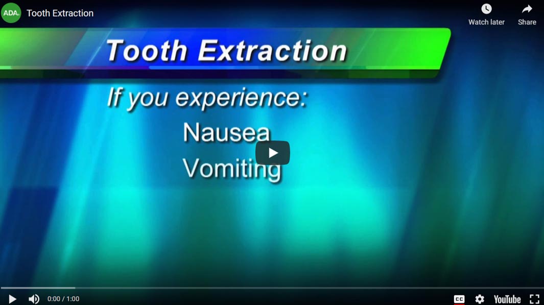 tooth-extraction